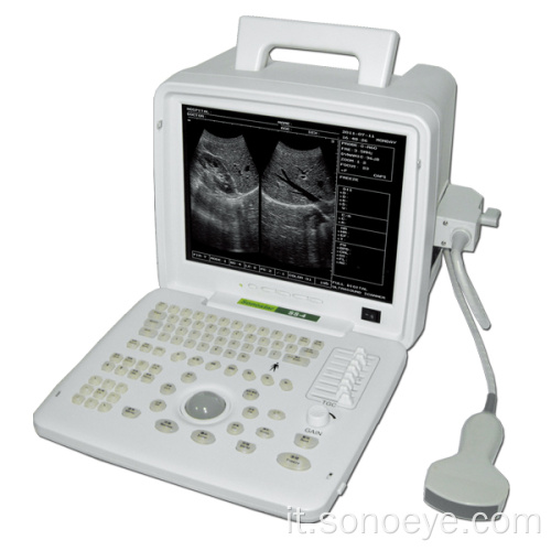 Macchina ad ultrasuoni in bianco e nero